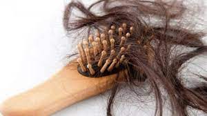 تساقط الشعر للنساء: الأسباب والعلاجات المتاحة